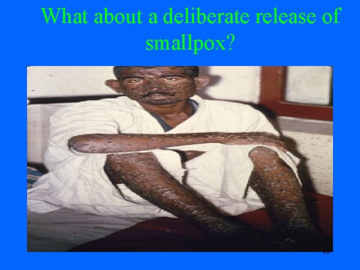 What about a deliberate release of smallpox? 99 