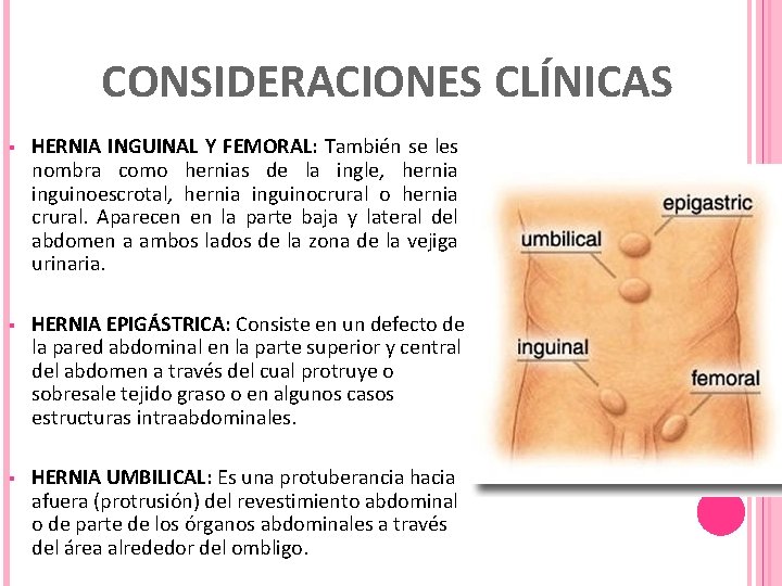 CONSIDERACIONES CLÍNICAS § HERNIA INGUINAL Y FEMORAL: También se les nombra como hernias de