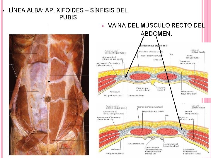 § LÍNEA ALBA: AP. XIFOIDES – SÍNFISIS DEL PÚBIS § VAINA DEL MÚSCULO RECTO