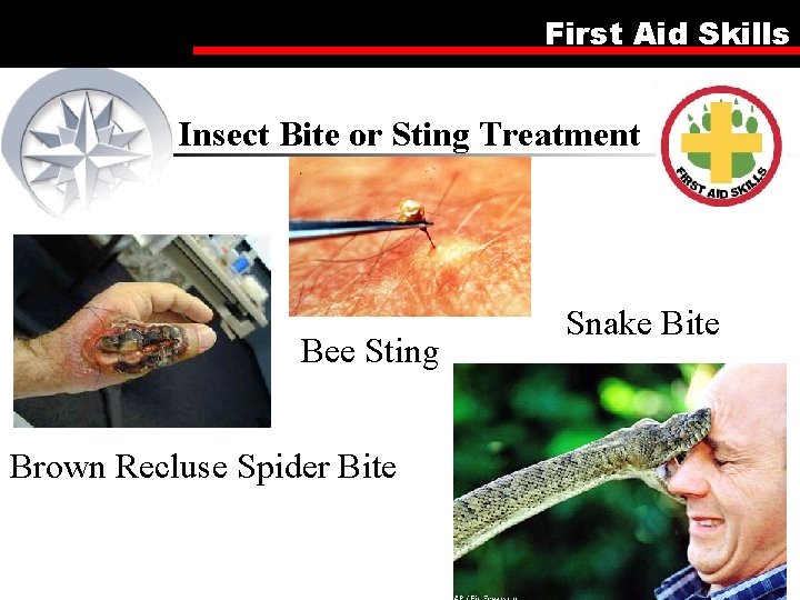 First Aid Skills Insect Bite or Sting Treatment Bee Sting Snake Bite Brown Recluse