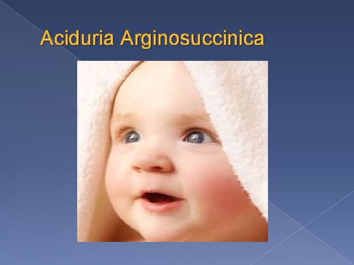 Aciduria Arginosuccinica 