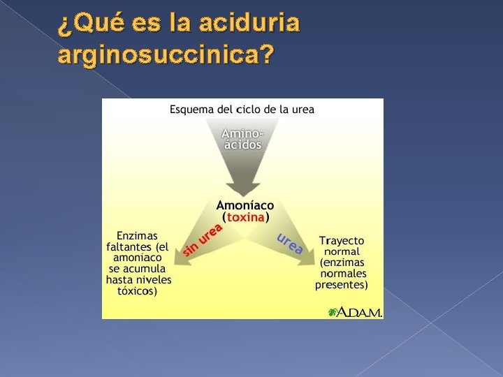 ¿Qué es la aciduria arginosuccinica? 