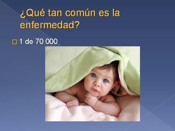¿Qué tan común es la enfermedad? � 1 de 70 000 