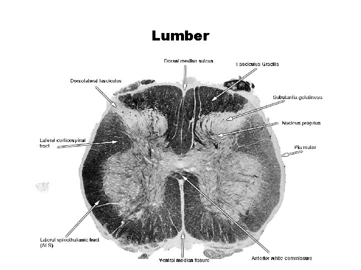 Lumber 