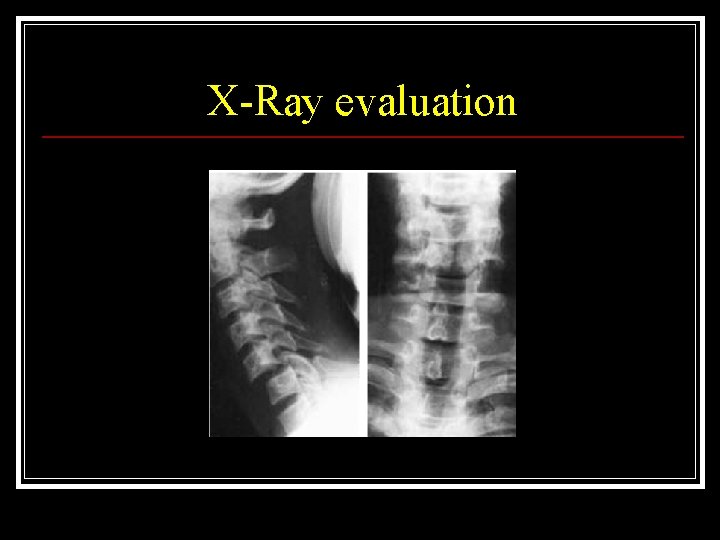 X-Ray evaluation 