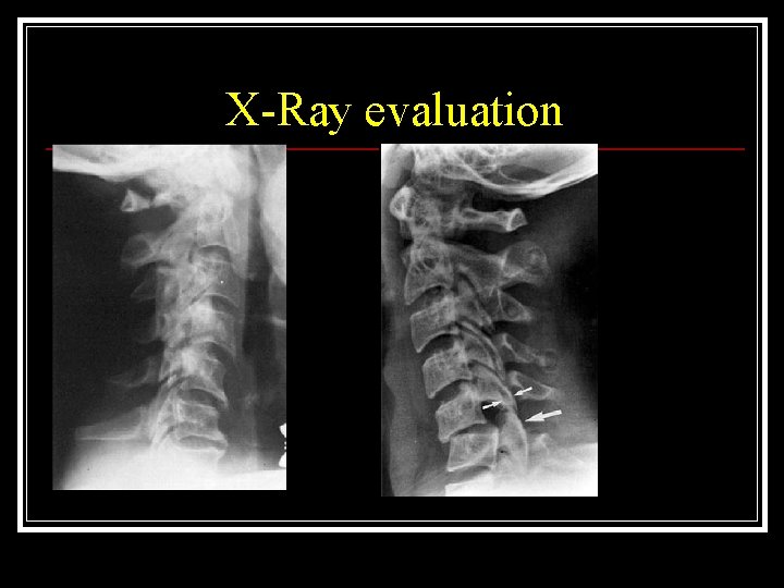 X-Ray evaluation 