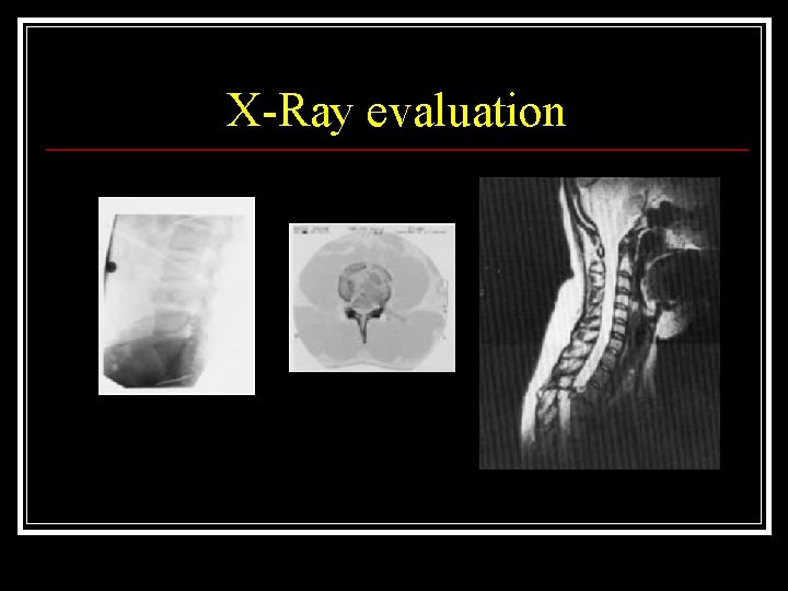 X-Ray evaluation 