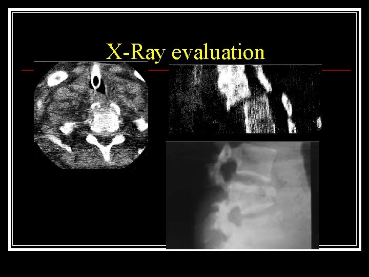 X-Ray evaluation 