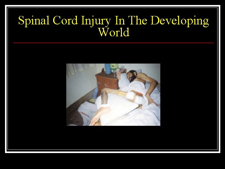 Spinal Cord Injury In The Developing World 