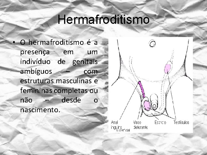 Hermafroditismo • O hermafroditismo é a presença em um indivíduo de genitais ambíguos –