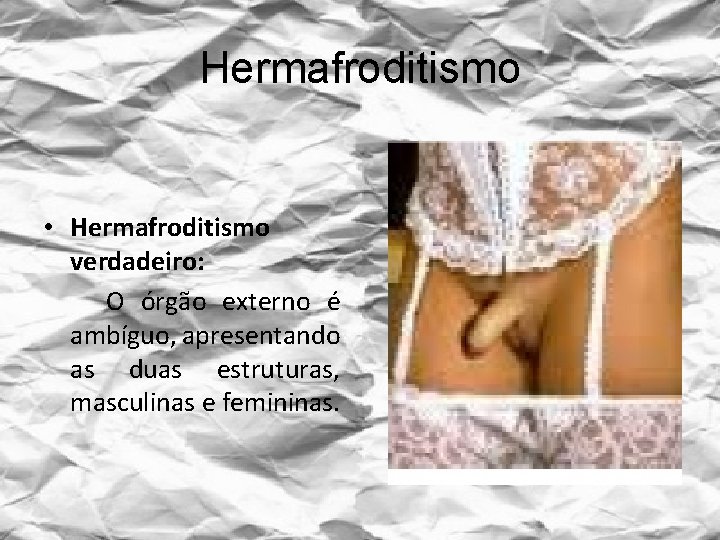 Hermafroditismo • Hermafroditismo verdadeiro: O órgão externo é ambíguo, apresentando as duas estruturas, masculinas
