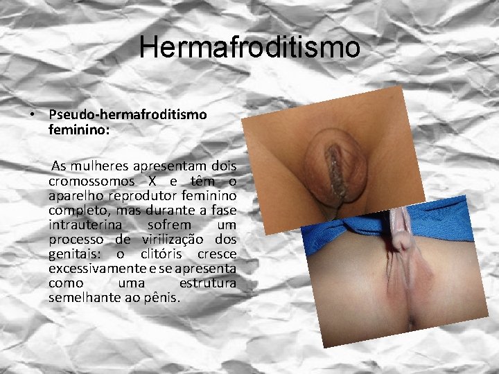 Hermafroditismo • Pseudo-hermafroditismo feminino: As mulheres apresentam dois cromossomos X e têm o aparelho