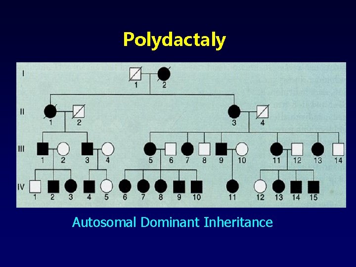 Polydactaly Autosomal Dominant Inheritance 