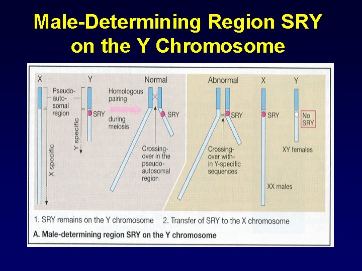 Male-Determining Region SRY on the Y Chromosome 