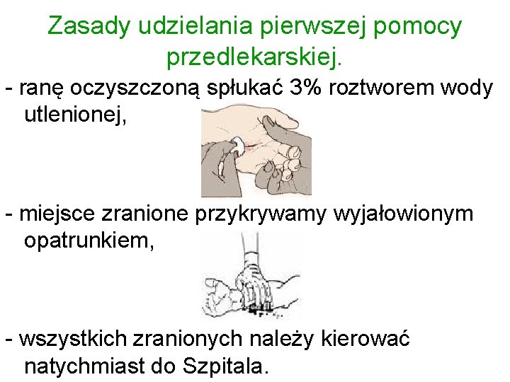 Zasady udzielania pierwszej pomocy przedlekarskiej. - ranę oczyszczoną spłukać 3% roztworem wody utlenionej, -