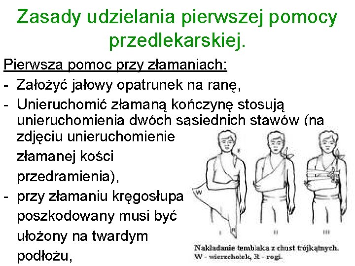 Zasady udzielania pierwszej pomocy przedlekarskiej. Pierwsza pomoc przy złamaniach: - Założyć jałowy opatrunek na