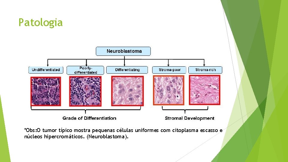 Patologia *Obs: O tumor típico mostra pequenas células uniformes com citoplasma escasso e núcleos