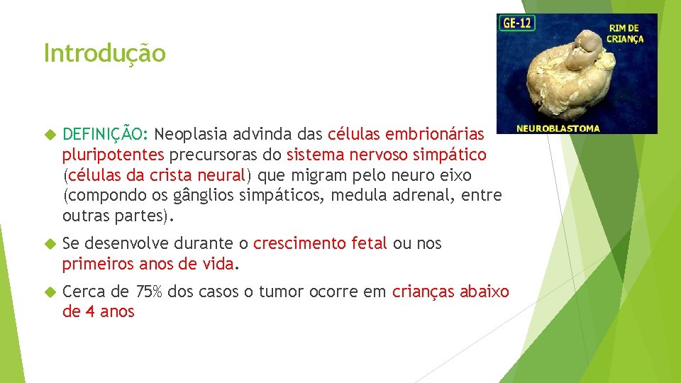 Introdução DEFINIÇÃO: Neoplasia advinda das células embrionárias pluripotentes precursoras do sistema nervoso simpático (células