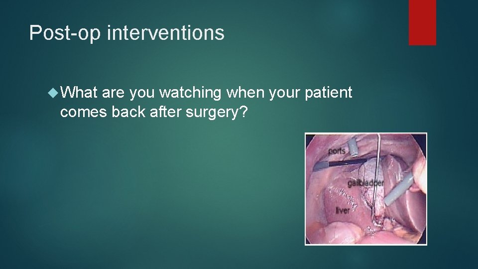 Post-op interventions What are you watching when your patient comes back after surgery? 