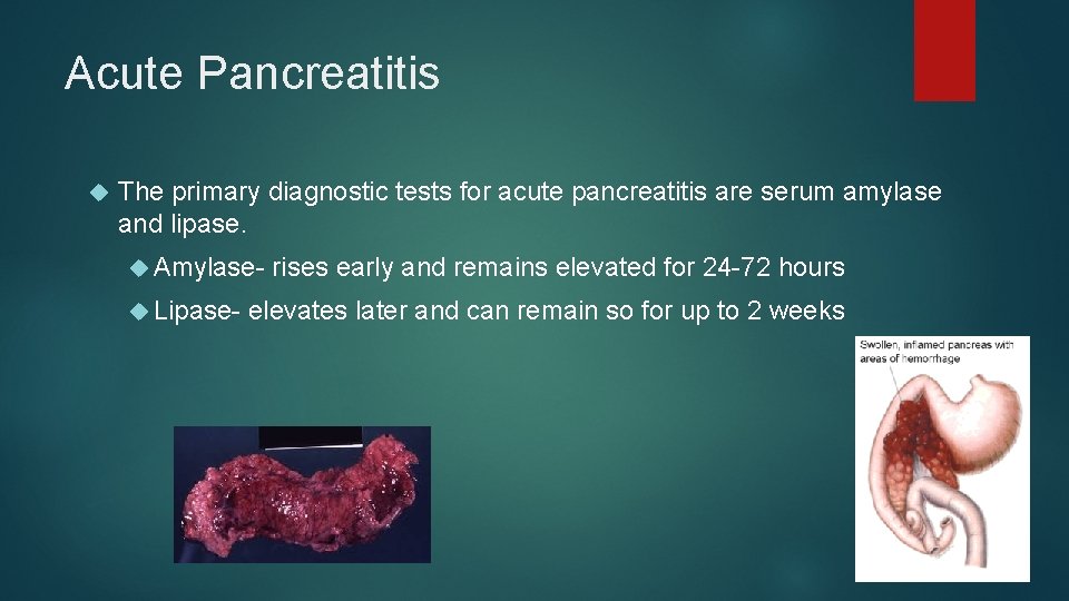 Acute Pancreatitis The primary diagnostic tests for acute pancreatitis are serum amylase and lipase.