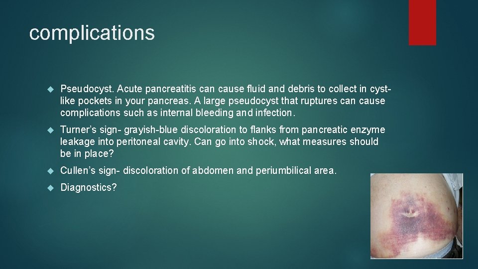 complications Pseudocyst. Acute pancreatitis can cause fluid and debris to collect in cystlike pockets