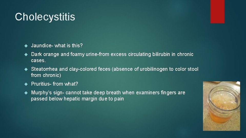Cholecystitis Jaundice- what is this? Dark orange and foamy urine-from excess circulating bilirubin in
