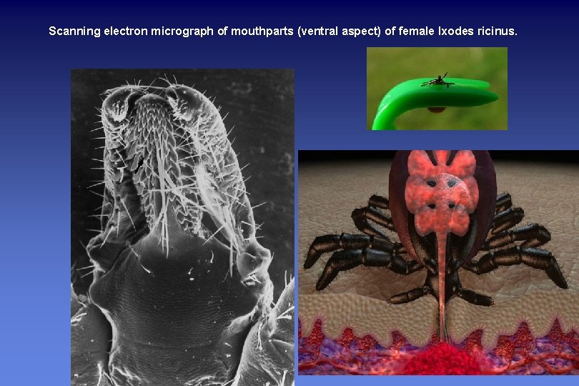 Scanning electron micrograph of mouthparts (ventral aspect) of female Ixodes ricinus. 