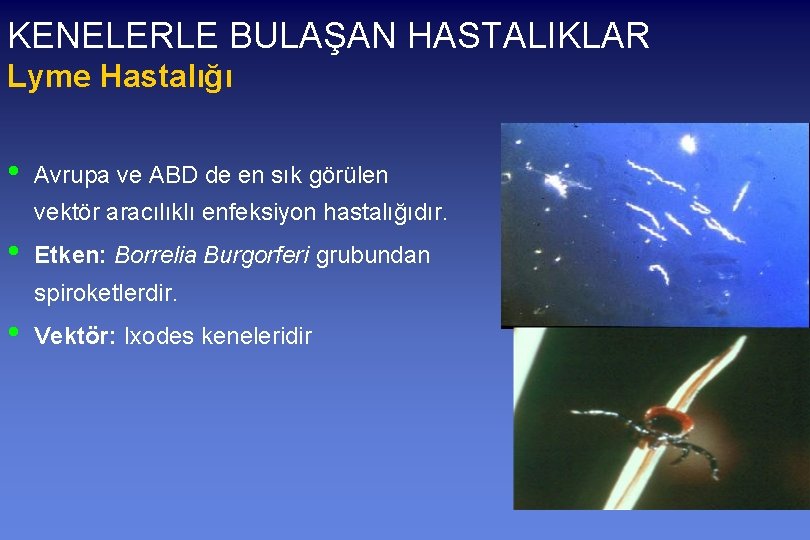 KENELERLE BULAŞAN HASTALIKLAR Lyme Hastalığı • Avrupa ve ABD de en sık görülen vektör