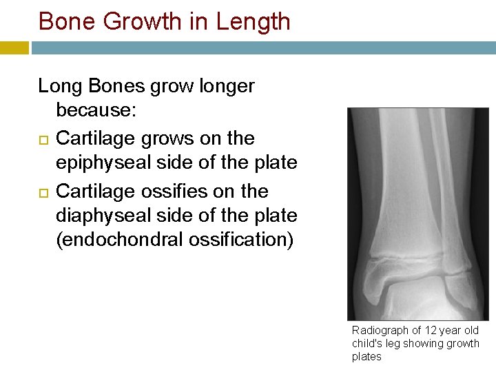 Bone Growth in Length Long Bones grow longer because: Cartilage grows on the epiphyseal