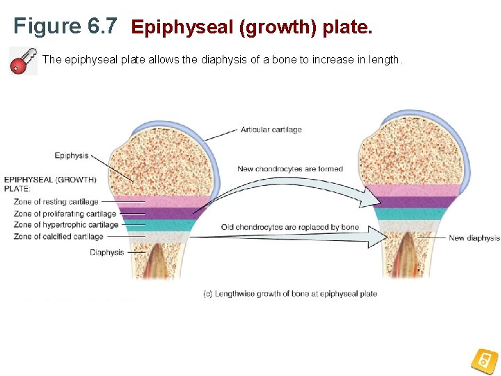 Figure 6. 7 Epiphyseal (growth) plate. The epiphyseal plate allows the diaphysis of a