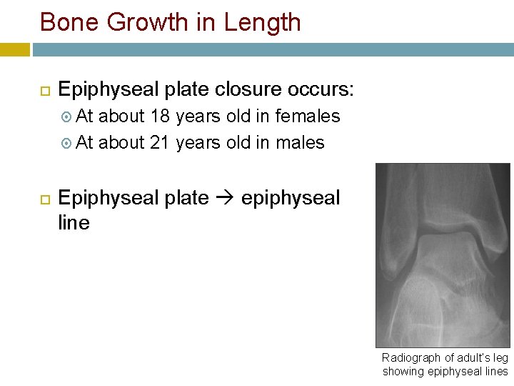 Bone Growth in Length Epiphyseal plate closure occurs: At about 18 years old in