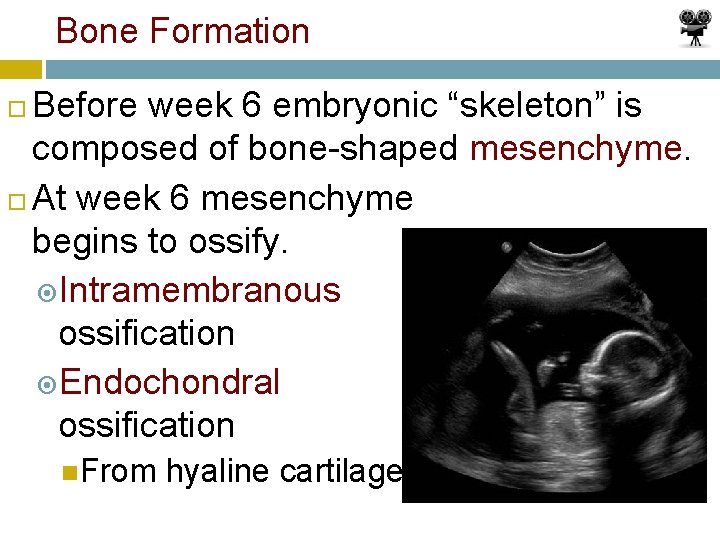 Bone Formation Before week 6 embryonic “skeleton” is composed of bone-shaped mesenchyme. At week