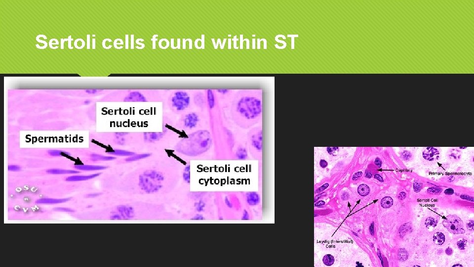 Sertoli cells found within ST 