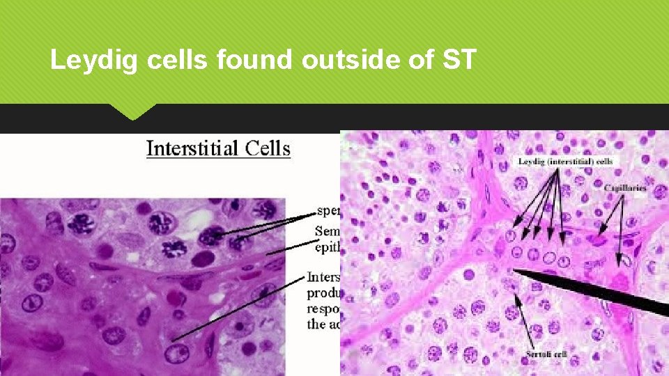 Leydig cells found outside of ST 