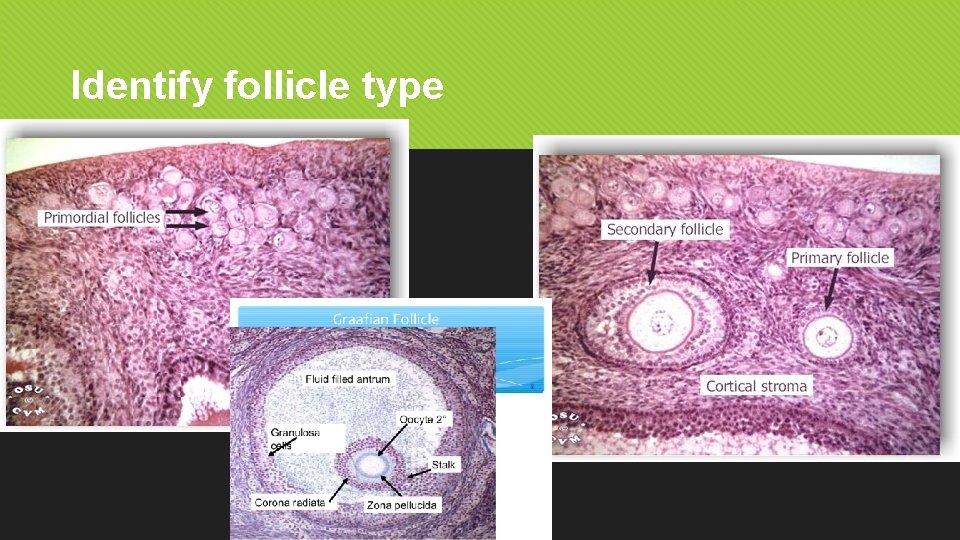 Identify follicle type 