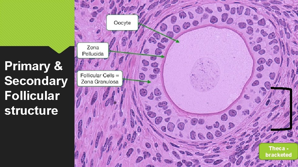 Primary & Secondary Follicular structure Theca bracketed 