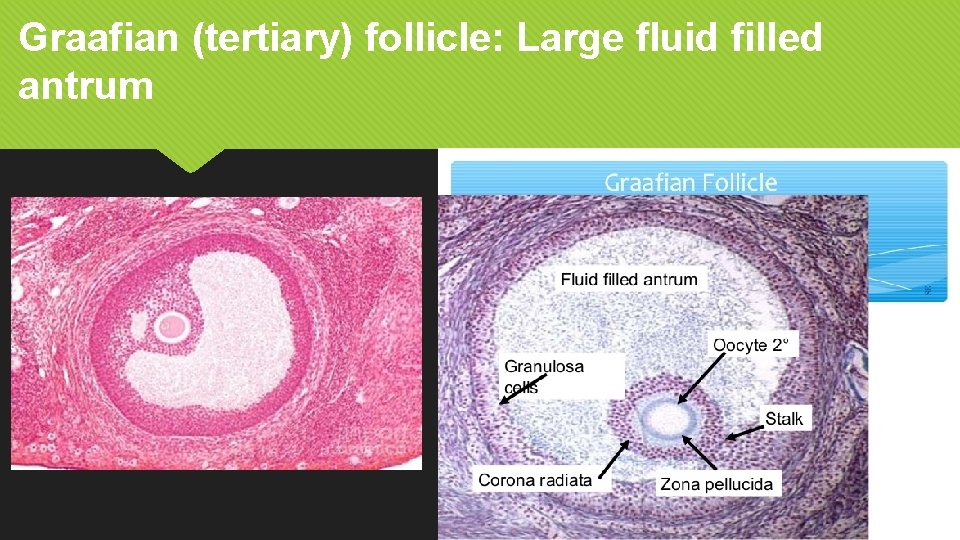 Graafian (tertiary) follicle: Large fluid filled antrum 
