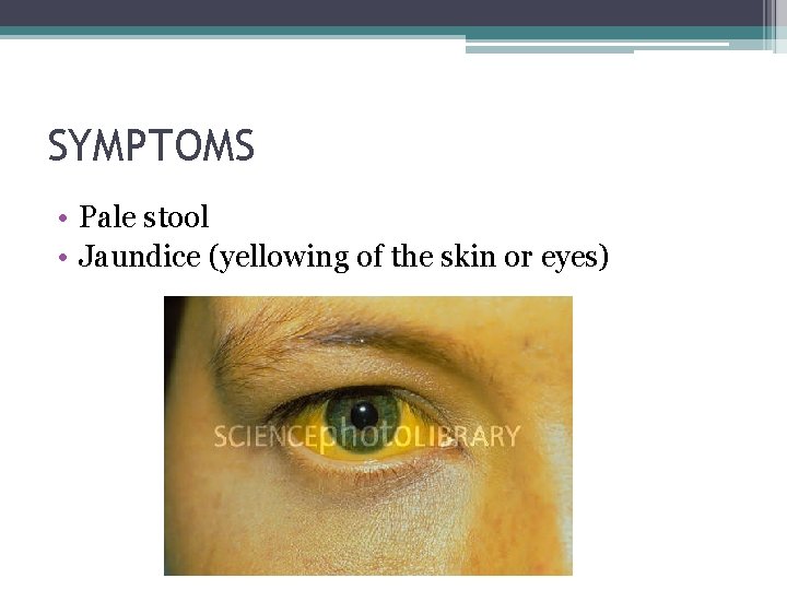 SYMPTOMS • Pale stool • Jaundice (yellowing of the skin or eyes) 