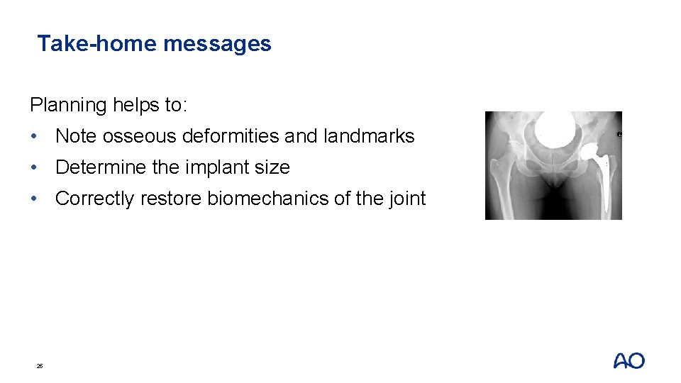 Take-home messages Planning helps to: • Note osseous deformities and landmarks • Determine the