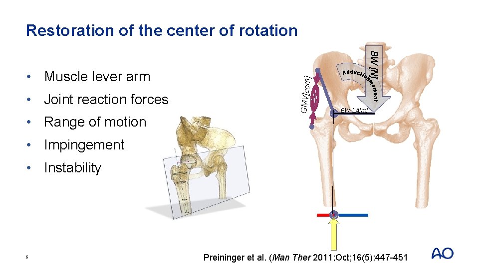 Restoration of the center of rotation ] GMV[ccm • Joint reaction forces BW [N]