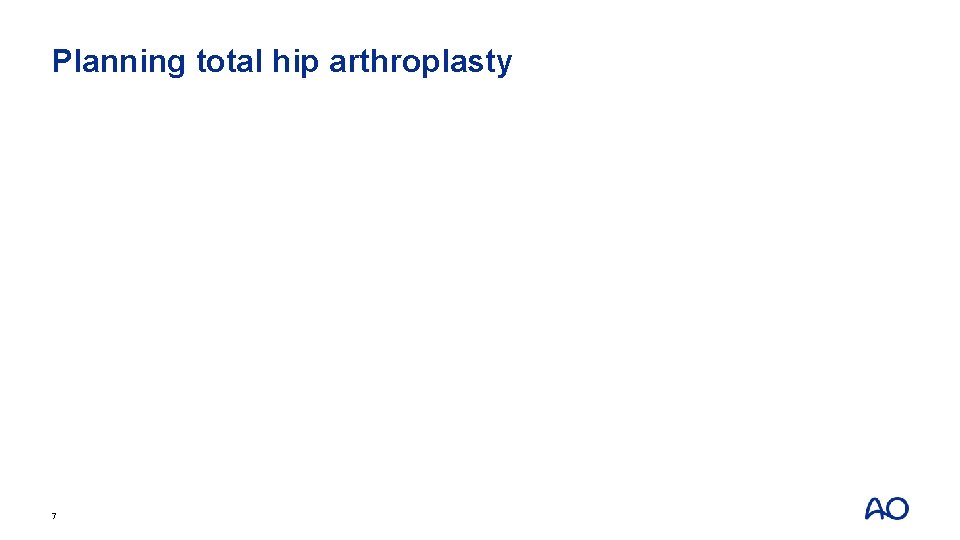 Planning total hip arthroplasty 7 