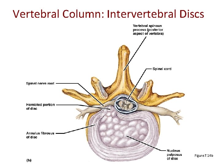 Vertebral Column: Intervertebral Discs Figure 7. 14 b 