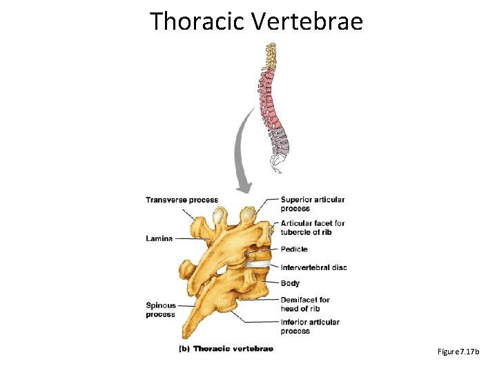 Thoracic Vertebrae Figure 7. 17 b 