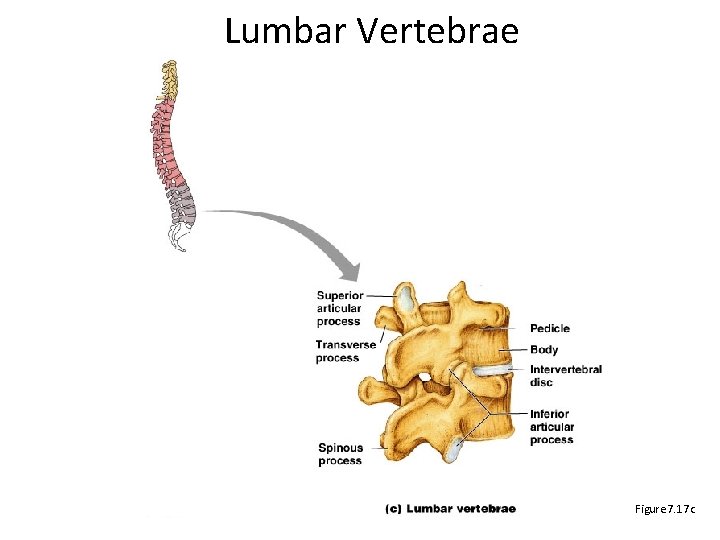 Lumbar Vertebrae Figure 7. 17 c 