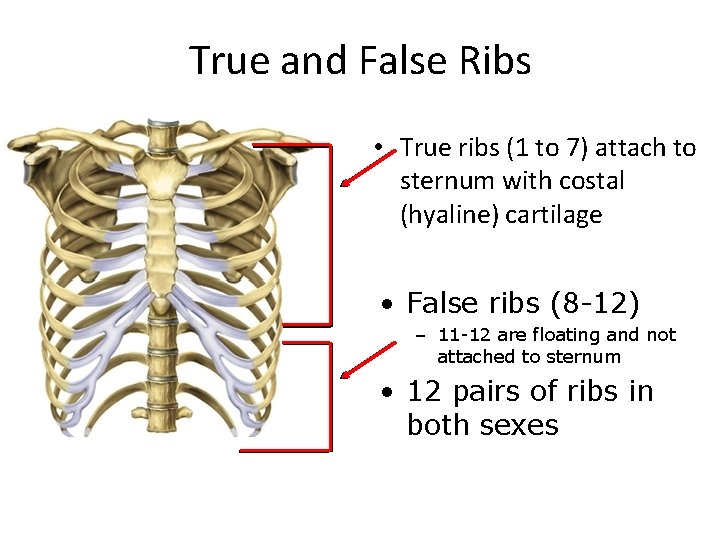 True and False Ribs • True ribs (1 to 7) attach to sternum with