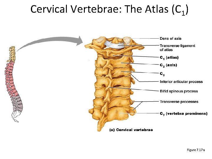 Cervical Vertebrae: The Atlas (C 1) Figure 7. 17 a 