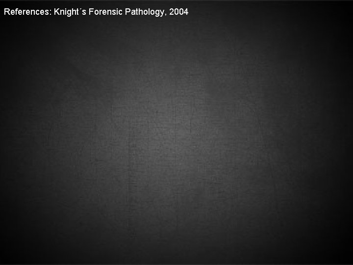 References: Knight´s Forensic Pathology, 2004 
