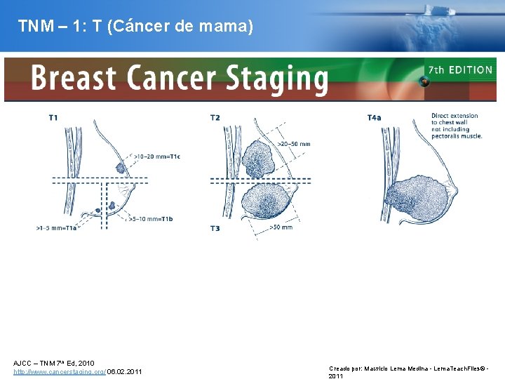 TNM – 1: T (Cáncer de mama) AJCC – TNM 7 th Ed, 2010