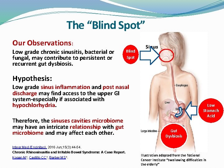 The “Blind Spot” Our Observations: Low grade chronic sinusitis, bacterial or fungal, may contribute