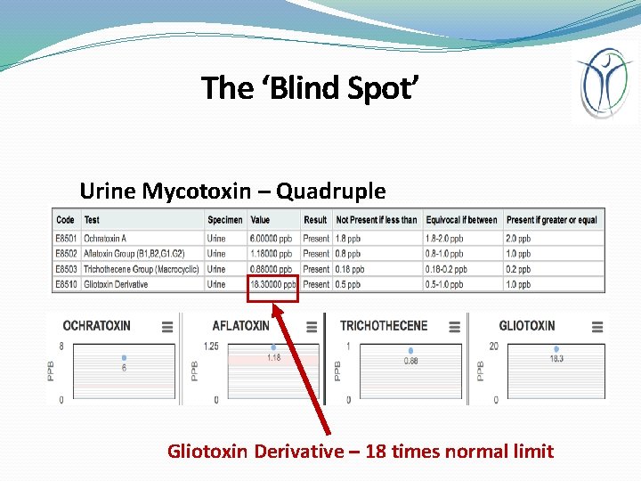 The ‘Blind Spot’ Urine Mycotoxin – Quadruple Positive Gliotoxin Derivative – 18 times normal